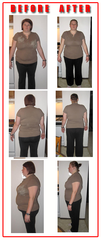 before-jennifer-delacruz- after rear